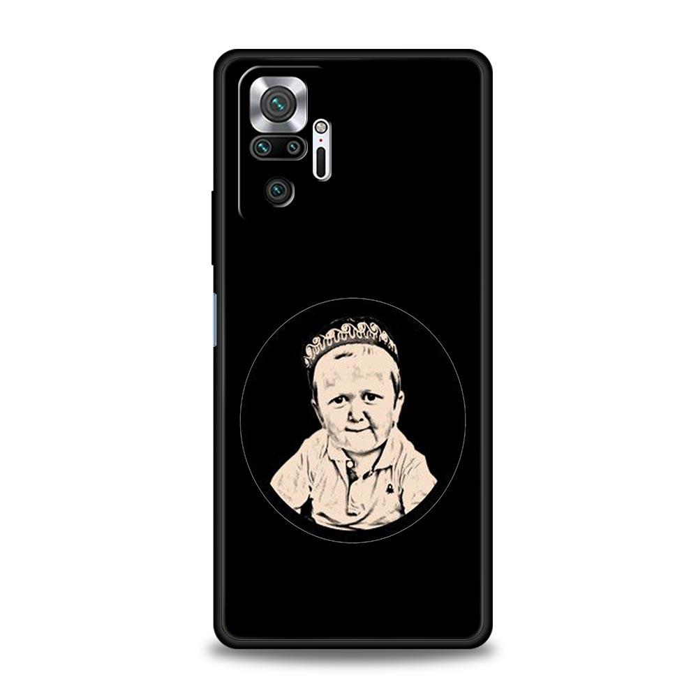 Funny Babaite Hasbulla Phone Case For Xiaomi Redmi Note 15 14 13 12 5G 11 10 Pro Plus 4G 9S 14C 13C 12C 10C Soft TPU Cover
