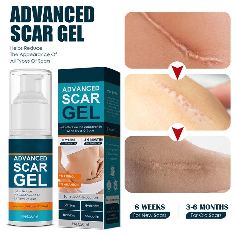 Scar Gel for Face Body Skin Care Scar Treatment for Both Old And Scars 50ml Make Scars Smaller & Less Visible Body Creams
