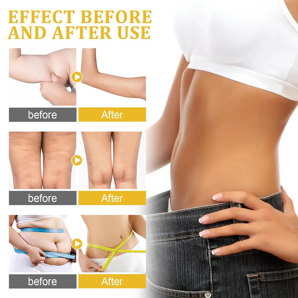 The Cream Eliminates Cellulite, Is Gentle and Non-irritating, Firms the Skin and Brightens the Complexion