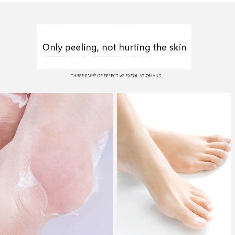 1Pair Exfoliating Foot Mask Foot Patch Magic Skin Peeling Dead Skin Feet Mask Socks Sosu Socks for Pedicure Socks Cream