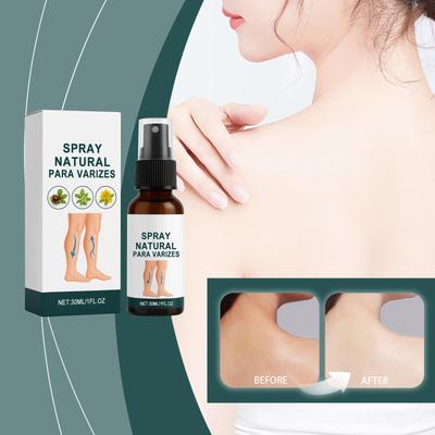 Körperspray verbessert die Durchblutung, reduziert Schwellungen und nährt die Venen. Körperspray, 30 ml