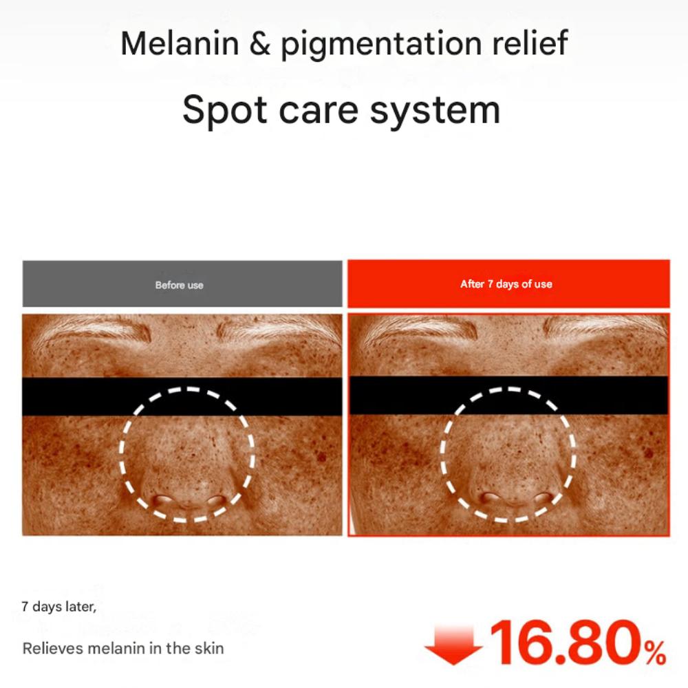 MediPeel MelanonX Freckle Cream Patch (2 sheets)