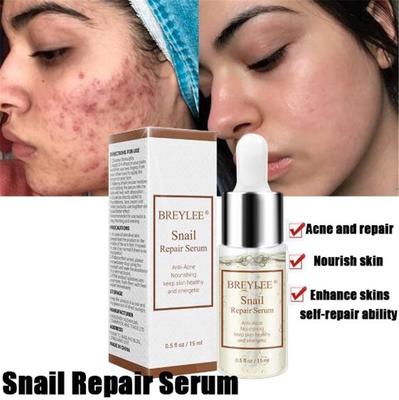 snail cream for scars