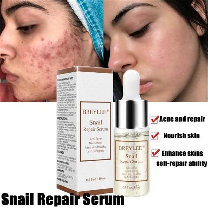 serum for scars