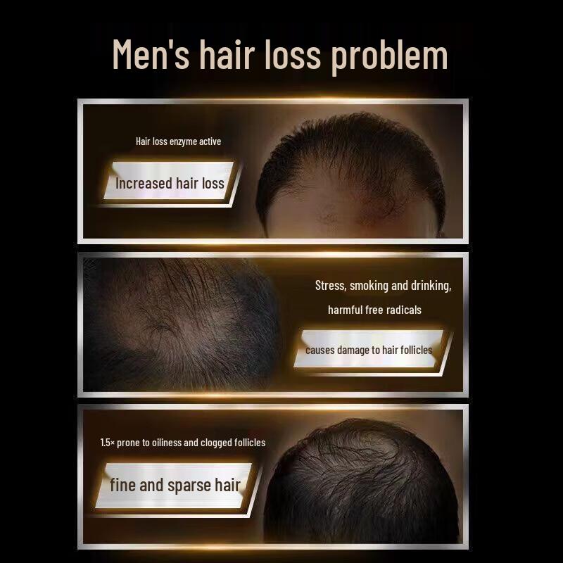 Clear Men Anti-Dandruff & Scalp Care Shampoo