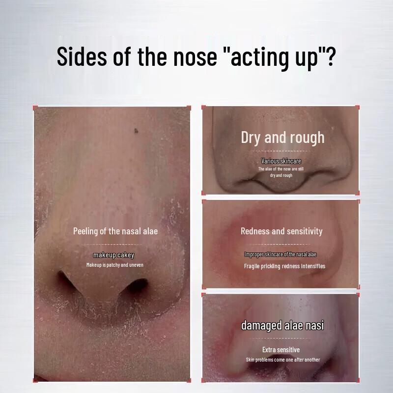 ADPWY Seborrheic Dermatitis Facial Relief Cream