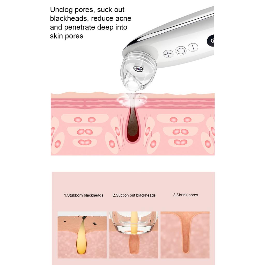 Elektrisches Mitessermessgerät zum Entfernen von Mitessern und Akne 200 W Pixel 6-Gang-Einstellung