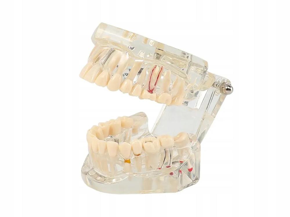 Dental Model 2 White (100) Gab_B