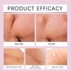 LANISKA Facial Gel Imprinting Patch Gentle care for dry lines, transparent cover of blemishes, easy-to-use patch