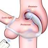 App Control Vibrator for Men Prostate Massager Dual Penis Ring Cock Rings Anal Vibrating Butt Plug Anal Sex Toy for Men Couples