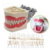 ADC Type Oral Teeth Model Dental Teaching Model Demonstration Tooth Model Subgingival Scaling of 32 PCS Teeth Removable