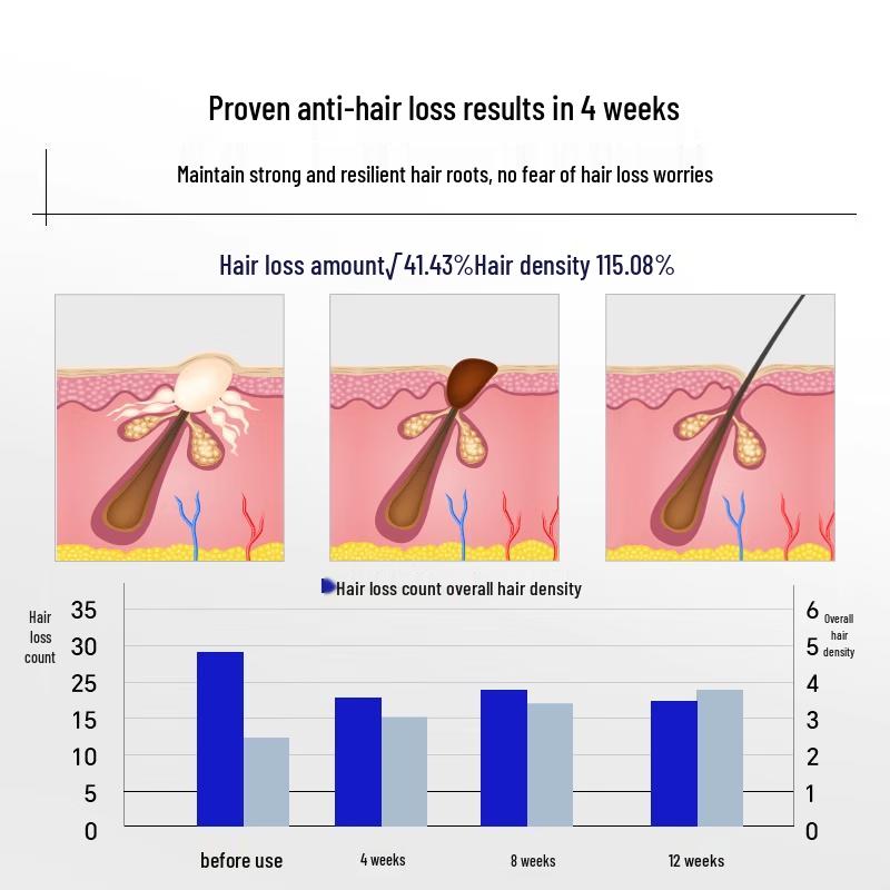 EHD Anti-Hair Loss & Strengthening Shampoo