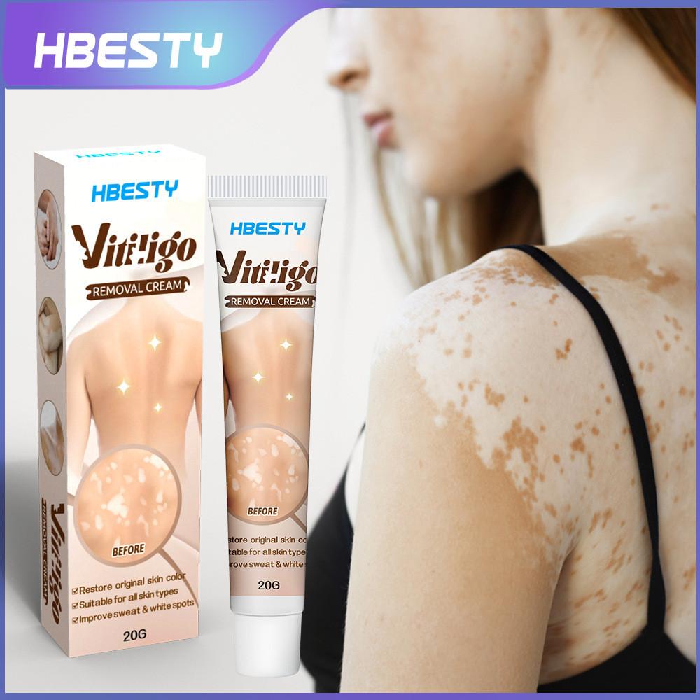 

Нежный отбеливающий крем для тела для ухода за пигментными пятнами на коже, разработан для всех типов кожи