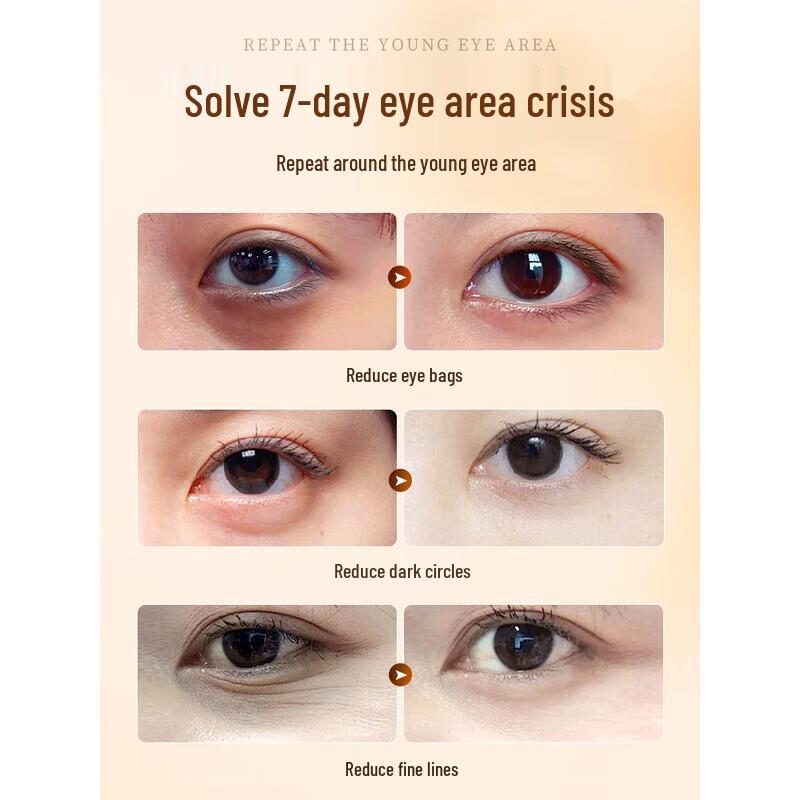 RUYI Plant Extract Anti-Wrinkle Eye Cream