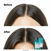 L'Oréal Professional Scalp Superior Treatment 200ml: Scalp care, for sensitive scalp, relieves discomfort, moisturizes, lightweight finish.