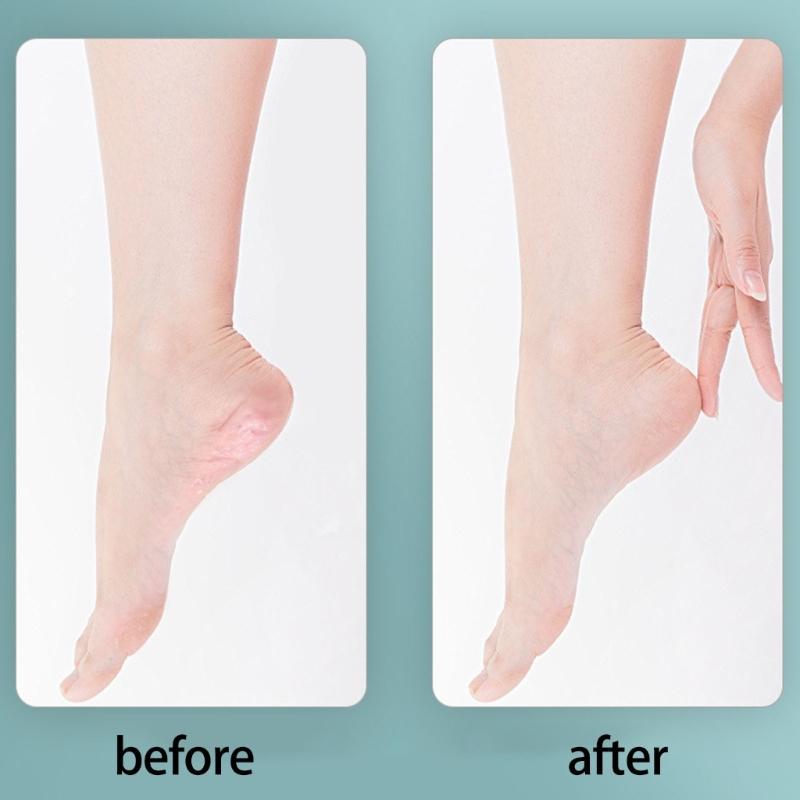 8/10 Pieces Foot Pedicure Set with Callus Remover Foot Files Foot Care Set Hard Skin Remover Set Feet Scrub for Daily