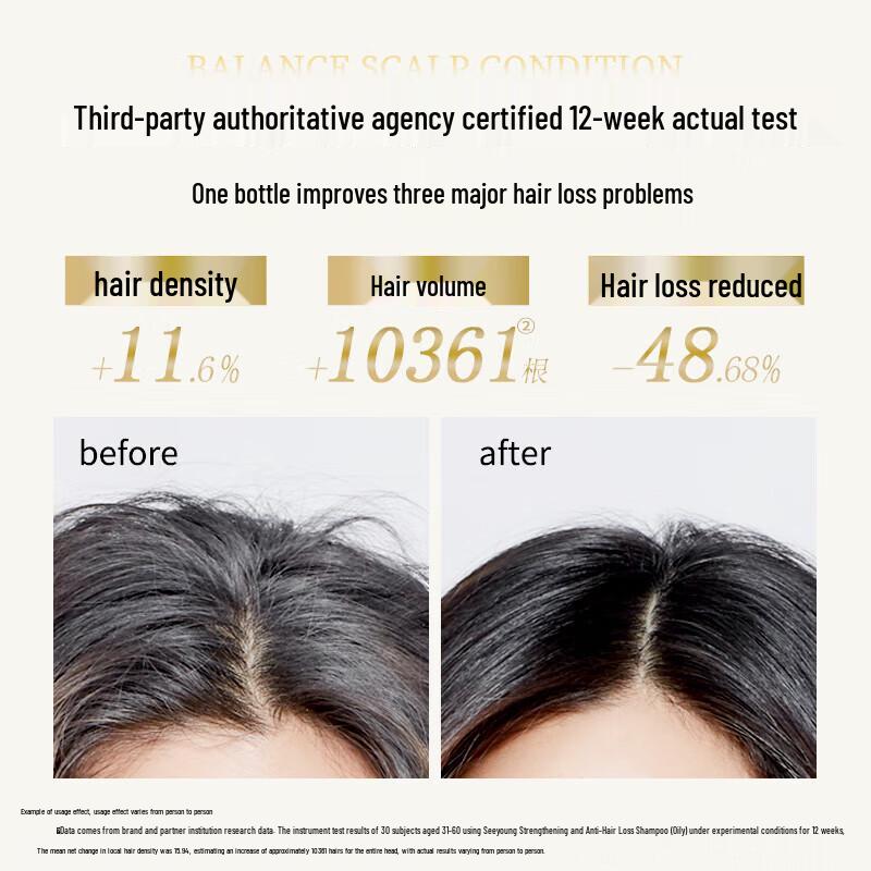 Ziyuan Anti-Hair Loss & Oil Control Shampoo