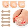 10Pcs/set Toenail Correction Tool Nail Treatment Elastic Patch Brace Pedicure Tool Nail Correction Stickers