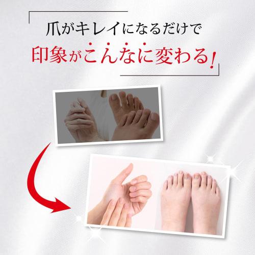 Over 500,000 Bottles Sold! Livonell EX Premium Nail Cleanser and Sanitizer (Approximately 1 Month's Supply) Moisturizing Nail Care Gel with Hyaluronic