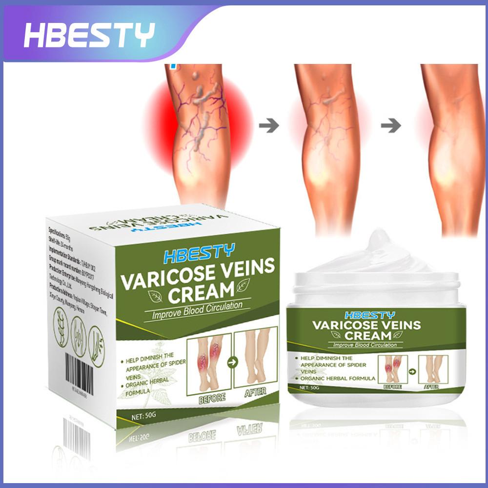 

Hbesty Крем для ног травяной от варикозного расширения вен Эффективное охлаждающее облегчение 50 г Уход за телом