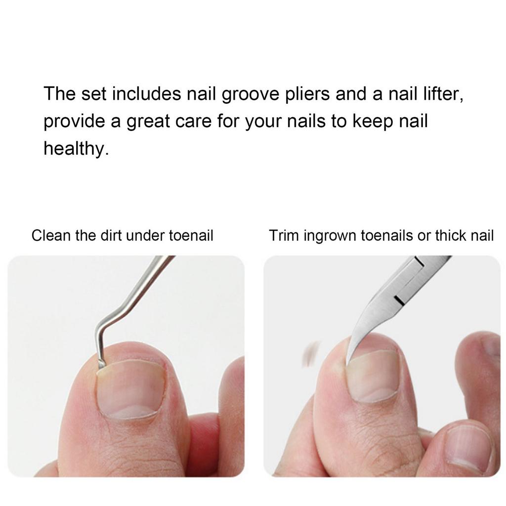 2Pcs Ingrown Toenail Tools Kit Stainless Steel Nail Cuticle Pliers Ingrown Nails Clipper Lifter Fingernail Toenail