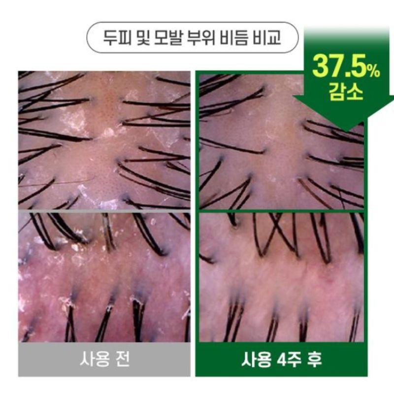 TS Anti-Dandruff Shampoo Scalp Care Itch Relief Sebum Control Treatment Shampoo 300g