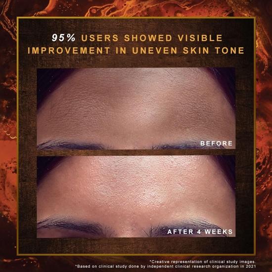 Indulekha Ayurvedic Proprietary Medicine Soap Pack of 3; 100 gm each bar, 300 gms packs