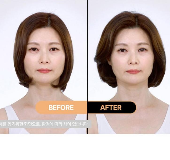 MED:ALL Hair Loss Care Nutrition Essence 120ml – Scalp Strengthening Treatment