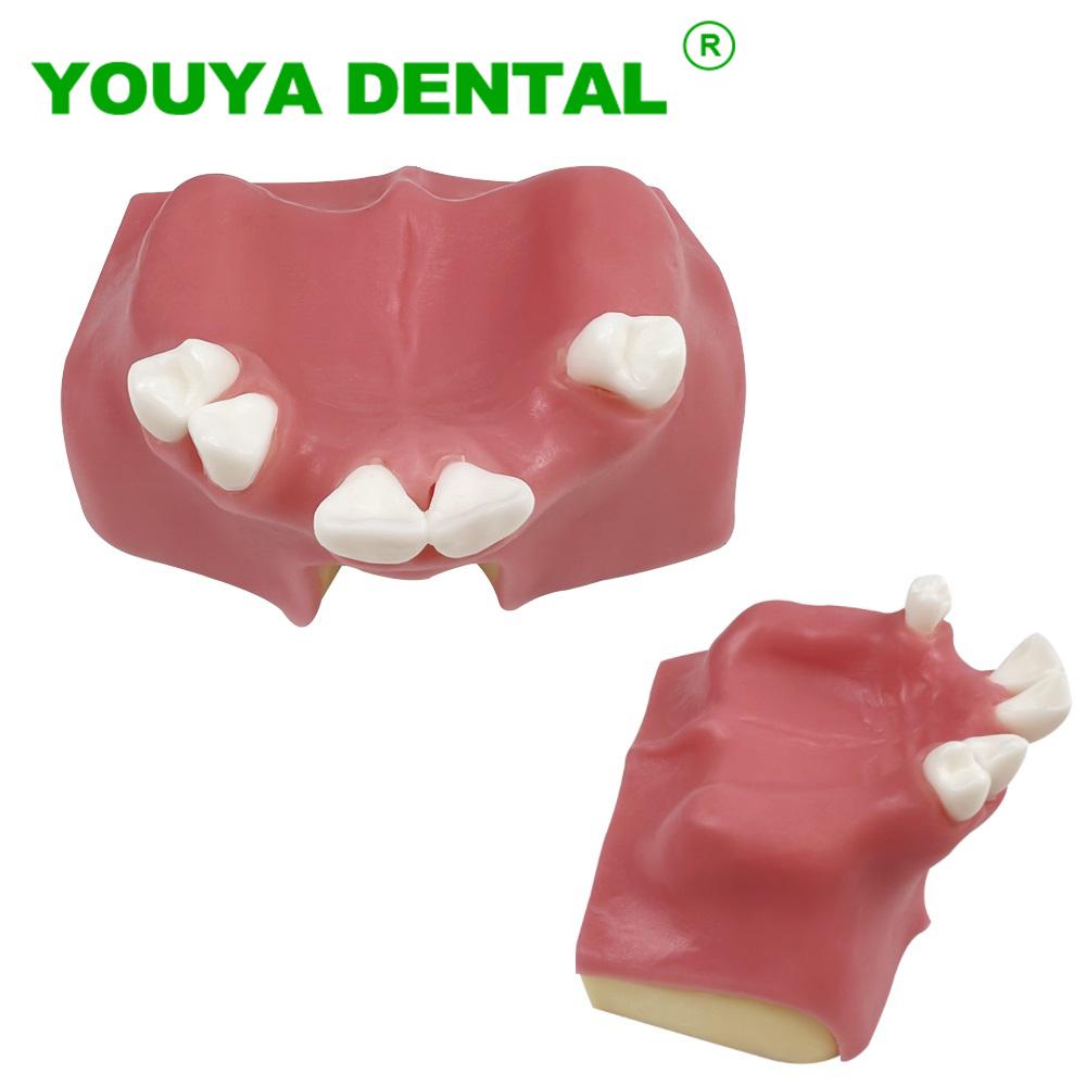 Dental Practice Model Maxillary Sinus Implant Model With Soft Gums Teeth Studying Teaching Oral Medical Communication Tools