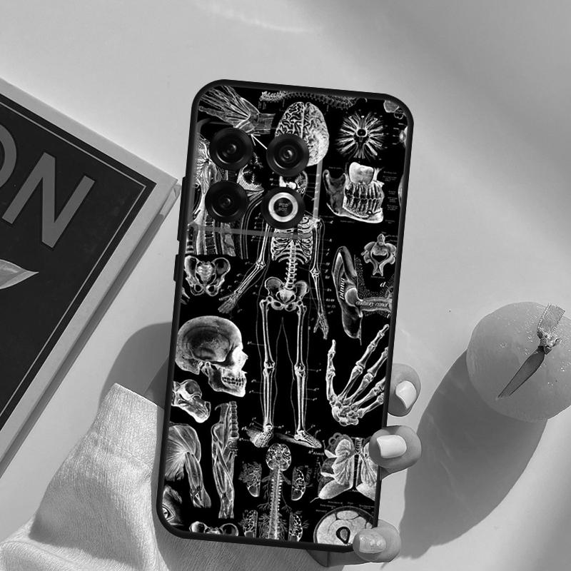 Human Heart Anatomy Case For OnePlus 13R 12R 10R 13T 10T 11 12 13 15 OnePlus Nord 5 CE 2 3 4 Lite N20 N30 Cover