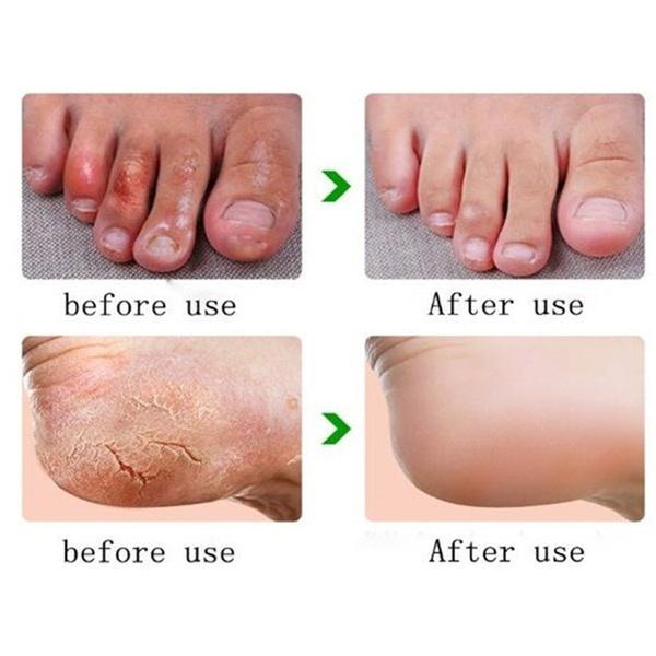 1 Box Horse Oil Hand And Foot Repair Cream Skin Moisturizing Foot Skin Care