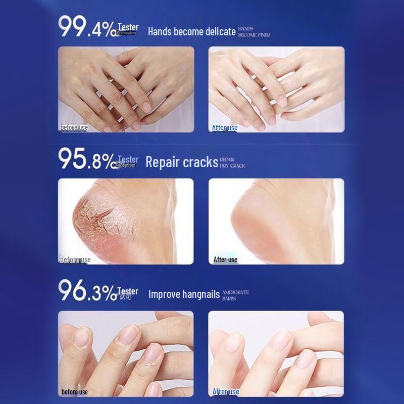 Baili Juren 110g Cremă Hidratantă Profundă cu Ulei de Șarpe