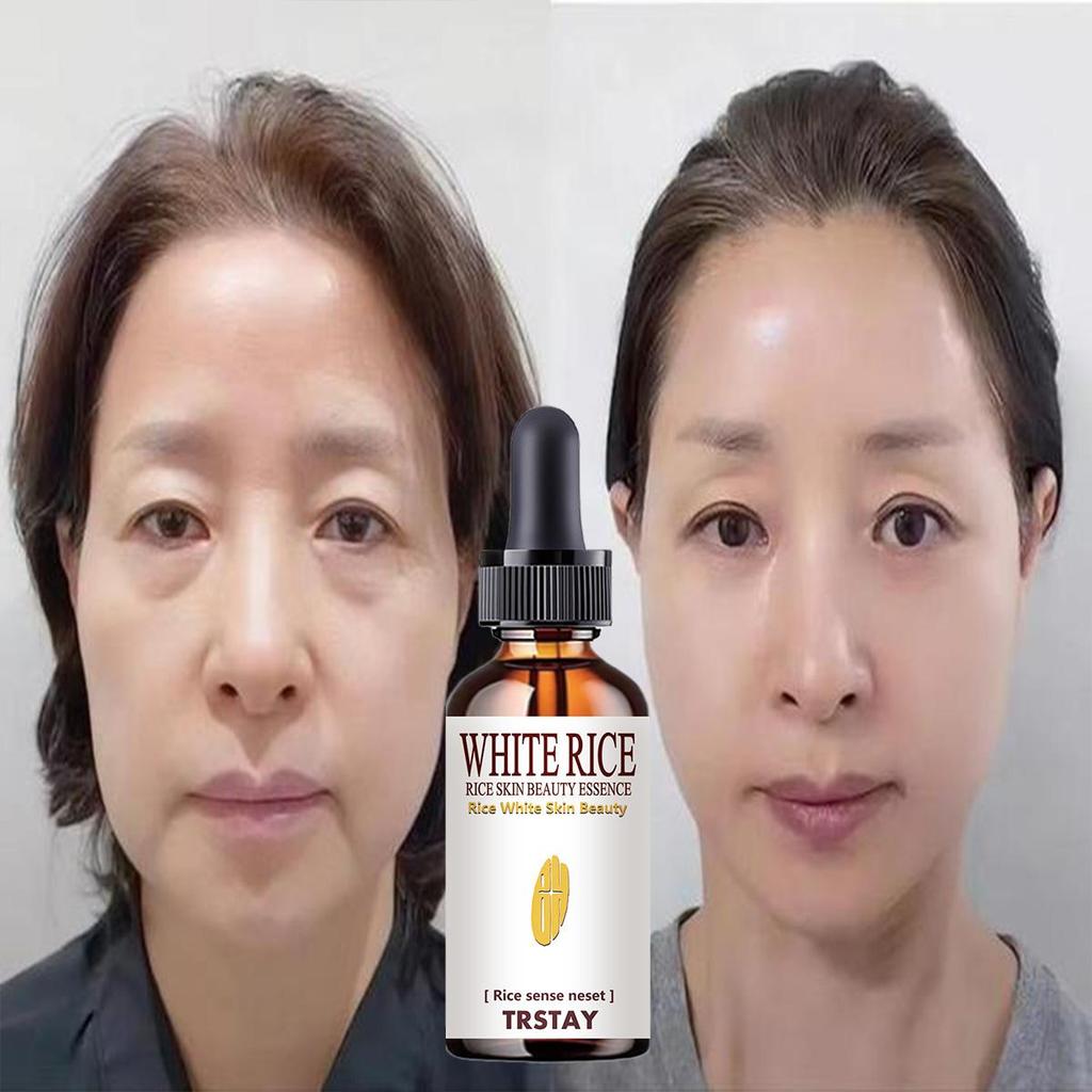 5ML/15ML/30ML/50ML/TRSTAY Esencja kwasu hialuronowego 24k Golden Face Nawilżający Rozjaśniający Przeciwstarzeniowy Zestaw do pielęgnacji skóry Esencja piękna do twarzy