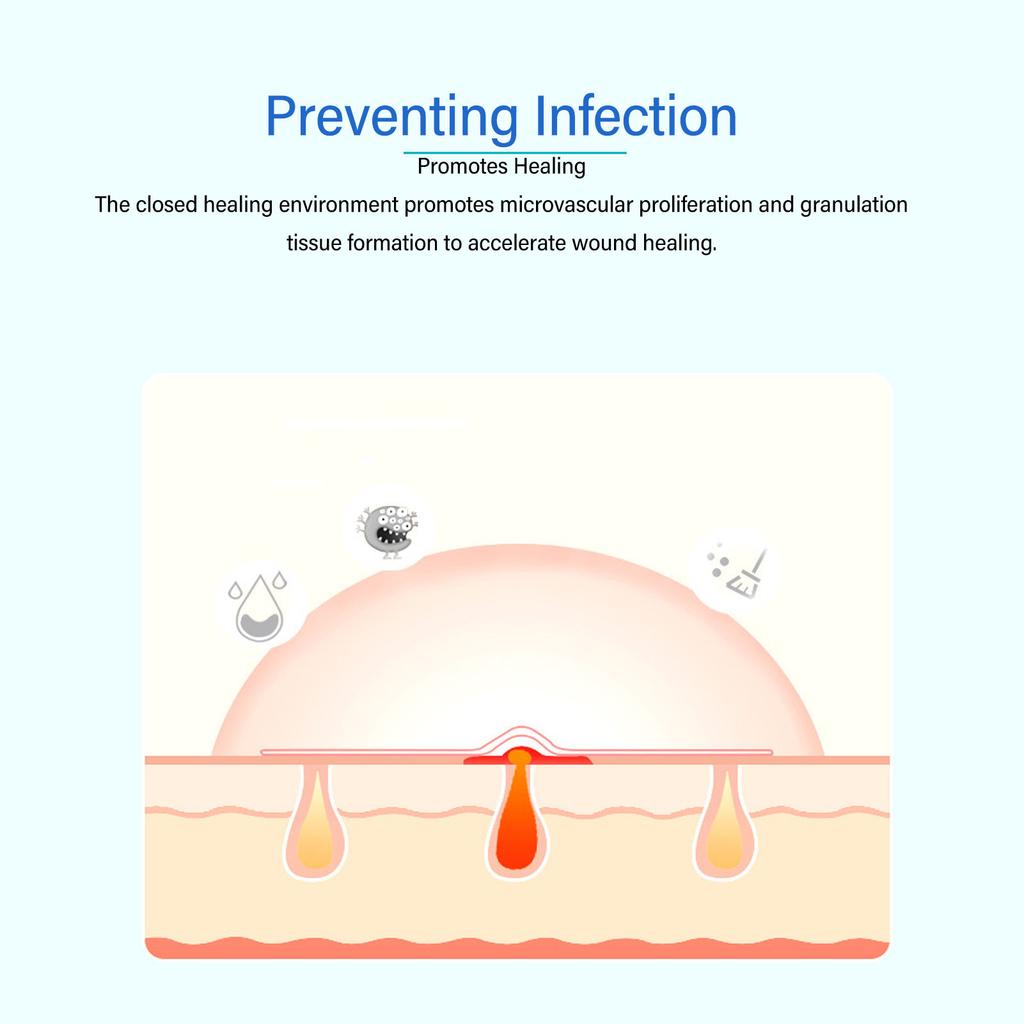 5PCS Hydrocolloid Gel Bandage Transparent Waterproof Hydrocolloid Wound Dressing