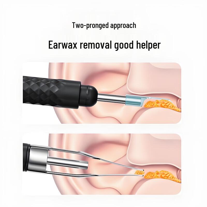 HKMRZ Professional Ear Cleaning Tools