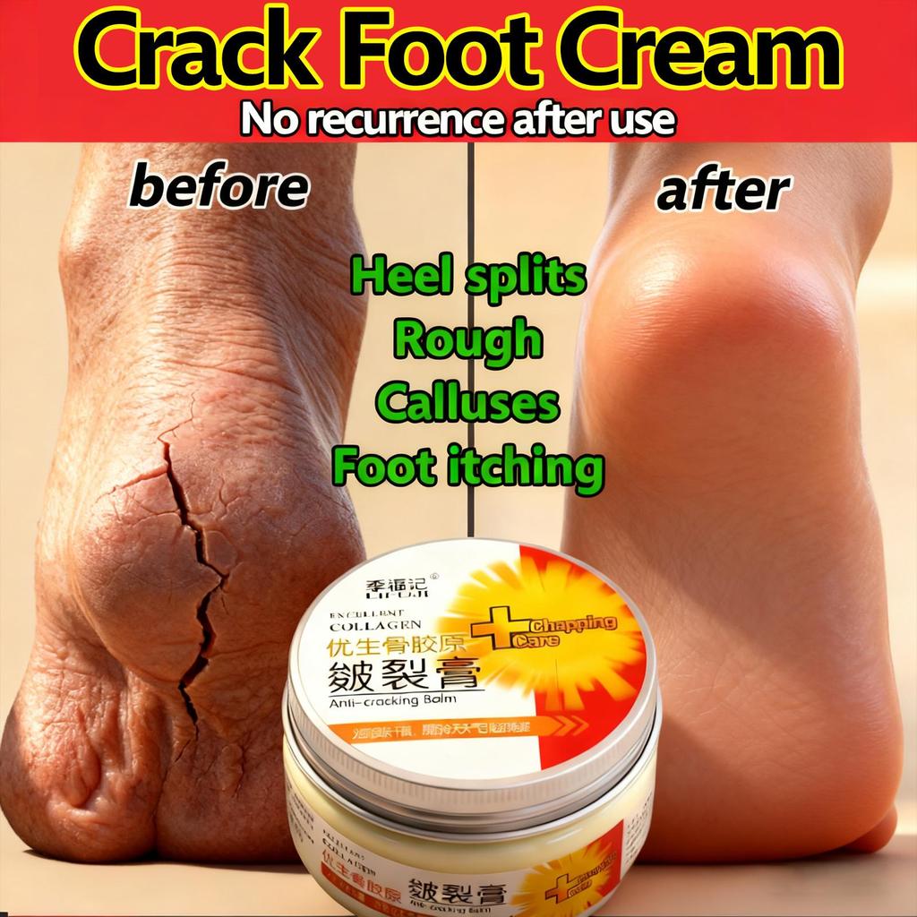 Anti Dry Crack Foot Cream Prevent Cracking Repair Cream Dryness Heel Exfoliating Remove Dead Repair Cream,Traditional Chinese Cosmetics,plaster