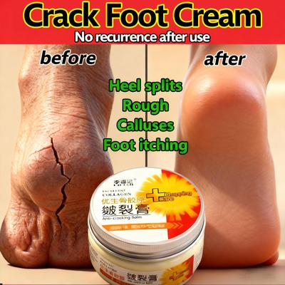 Anti Dry Crack Foot Cream Prevent Cracking Repair Cream Dryness Heel  Exfoliating Remove Dead Repair Cream,Traditional Chinese Cosmetics,plaster