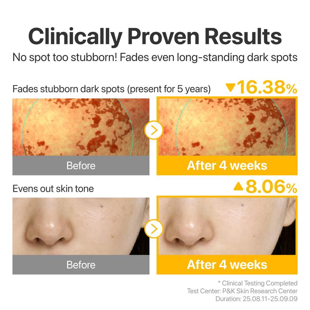 No.5 Glutathione TXA Advanced Dark Spot Ampoule Concentrate 10g