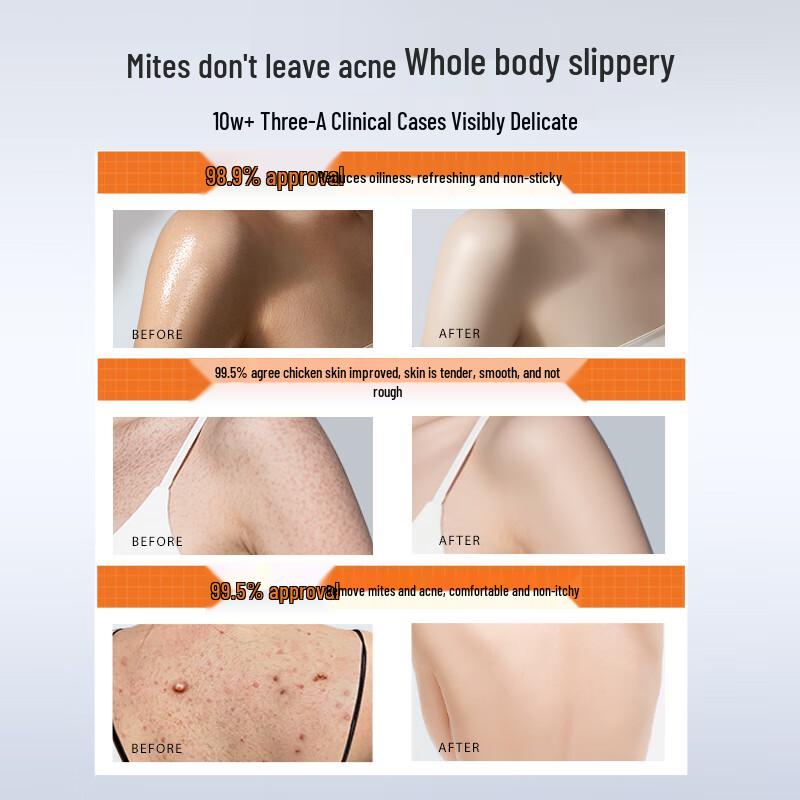 HURMEVKOR Sulfur Anti-Mite Acne Body Wash