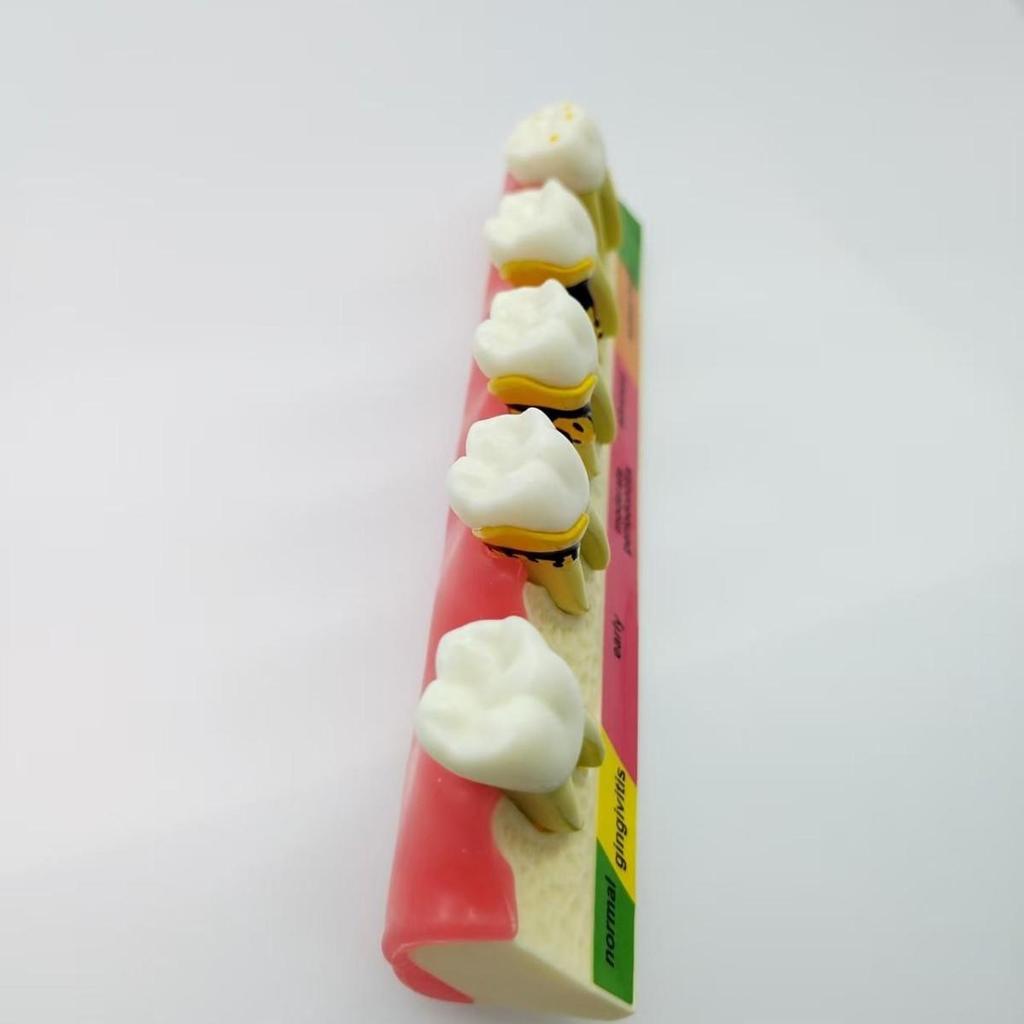 PH4010 Periodontal Classification Model: Dental Mold for Subgingival Calculus Scaling