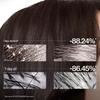 EHD Specialized Oil Control Anti-Dandruff Shampoo & Volumizing Mask Set