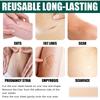 Scar Removal Gel Tape Self Adhesion Reusable Painless Scars Treatment Tapes for Hyperplastic Scars 59.1in