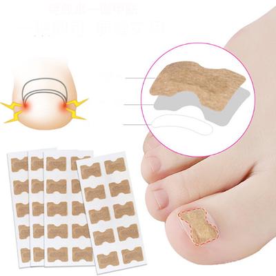 10Pcs/Set Ingrown Toenail Correction Patch – Therapeutic Nail Brace and Pedicure Care Tool