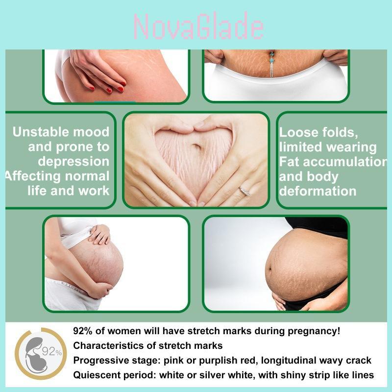 Jaysuing Skin Care Spray For Postpartum Skin Firming And Fine Line Reduction In 30ml Packaging