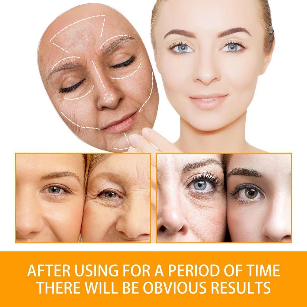 Brightening and Nourishing Cream Ginger Yellow Neck Cream Organic Whitening Skin Moisturizing and Moisturizing, Uniform Skin Color Moisturizing Cream