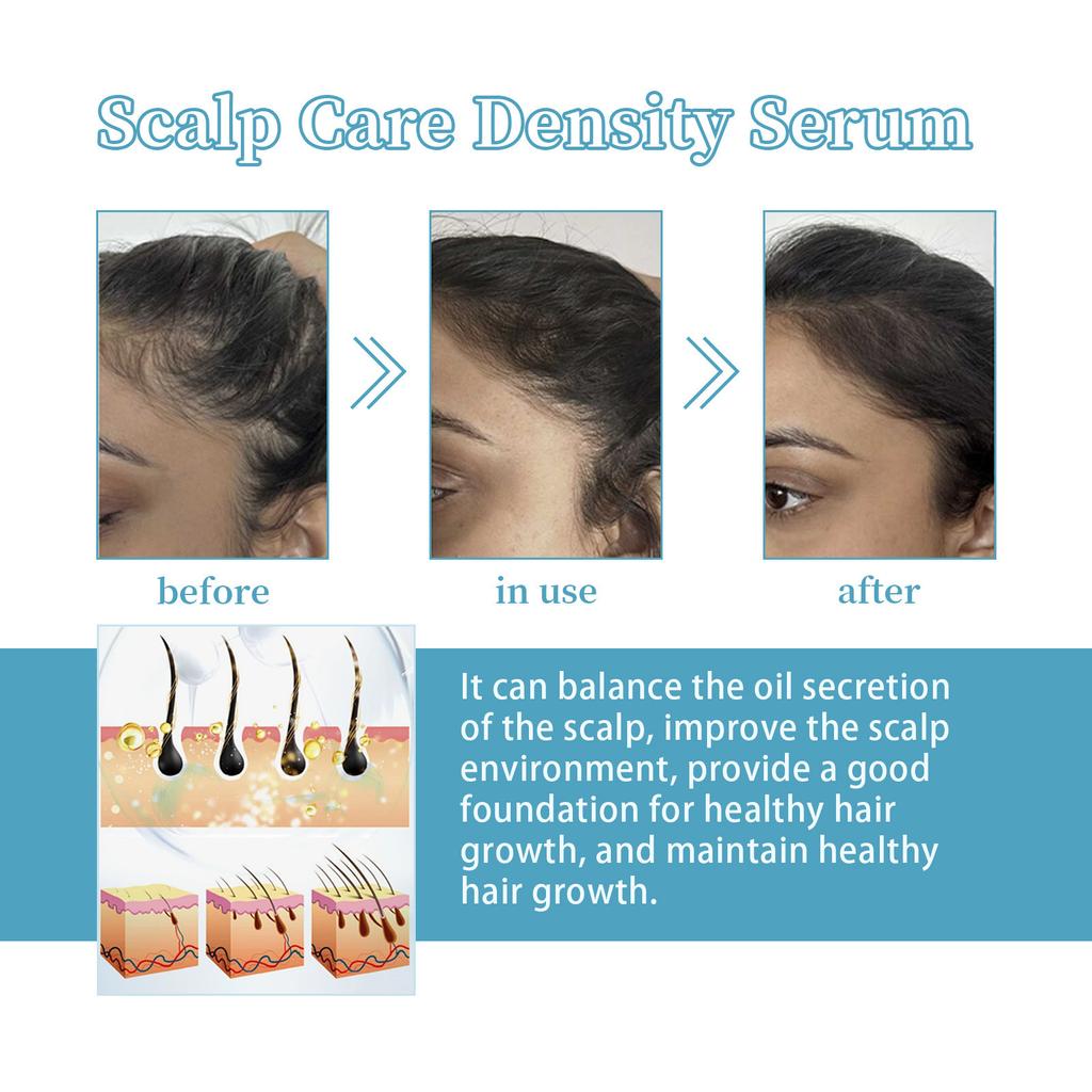 EELHOE Fermented Vitamin E Serum Natural Gentle Collagen Fermented Pisum Sativum Extract  Hair Essence Hair Growth Serum for Thinning Hair 30ml