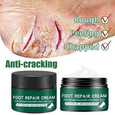 Effektive Geruchsbehandlung, pflegende Anti-Riss-Creme, Hautpflegeprodukte, Entferner abgestorbener Haut, rissige Reparaturcreme