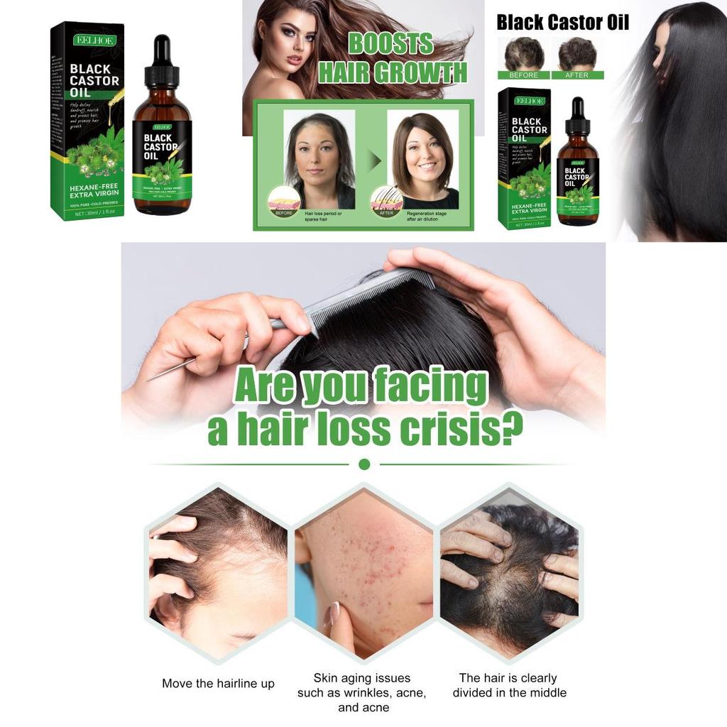 Eelhoe Castor Oil Hair Growth Serum Nourishing And Strengthening 30ml For Thicker Hair