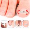 Ingrown Toenail Orthotic Patch & Foot Care Tool for Curled Nails and Nail Groove Ingrowth