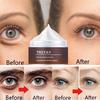 Temporary Eye Bags Removal Cream Instant Under Eye Firming And Tightening Eye Cream Lifts And Firms Eye Skin For Dark Circles
